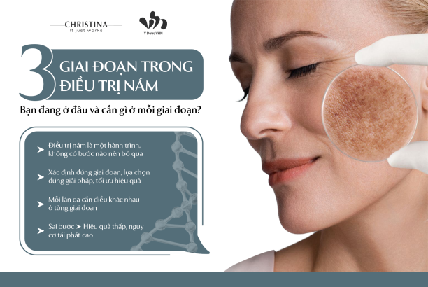3 giai đoạn trong điều trị nám Bạn đang ở đâu và cần gì ở mỗi giai đoạn